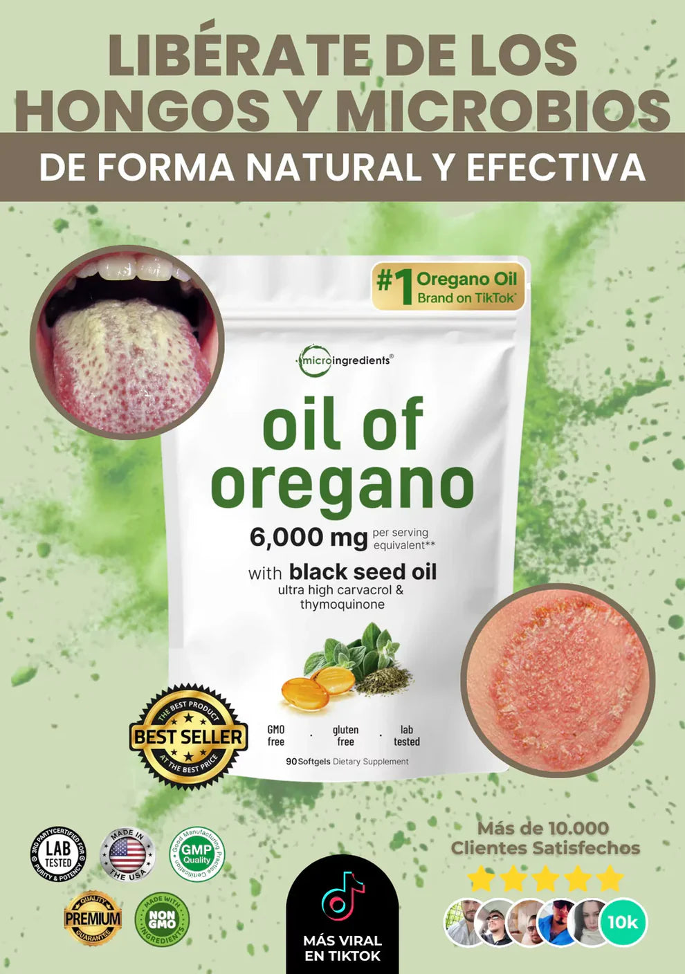 Aceite de Orégano 🌱